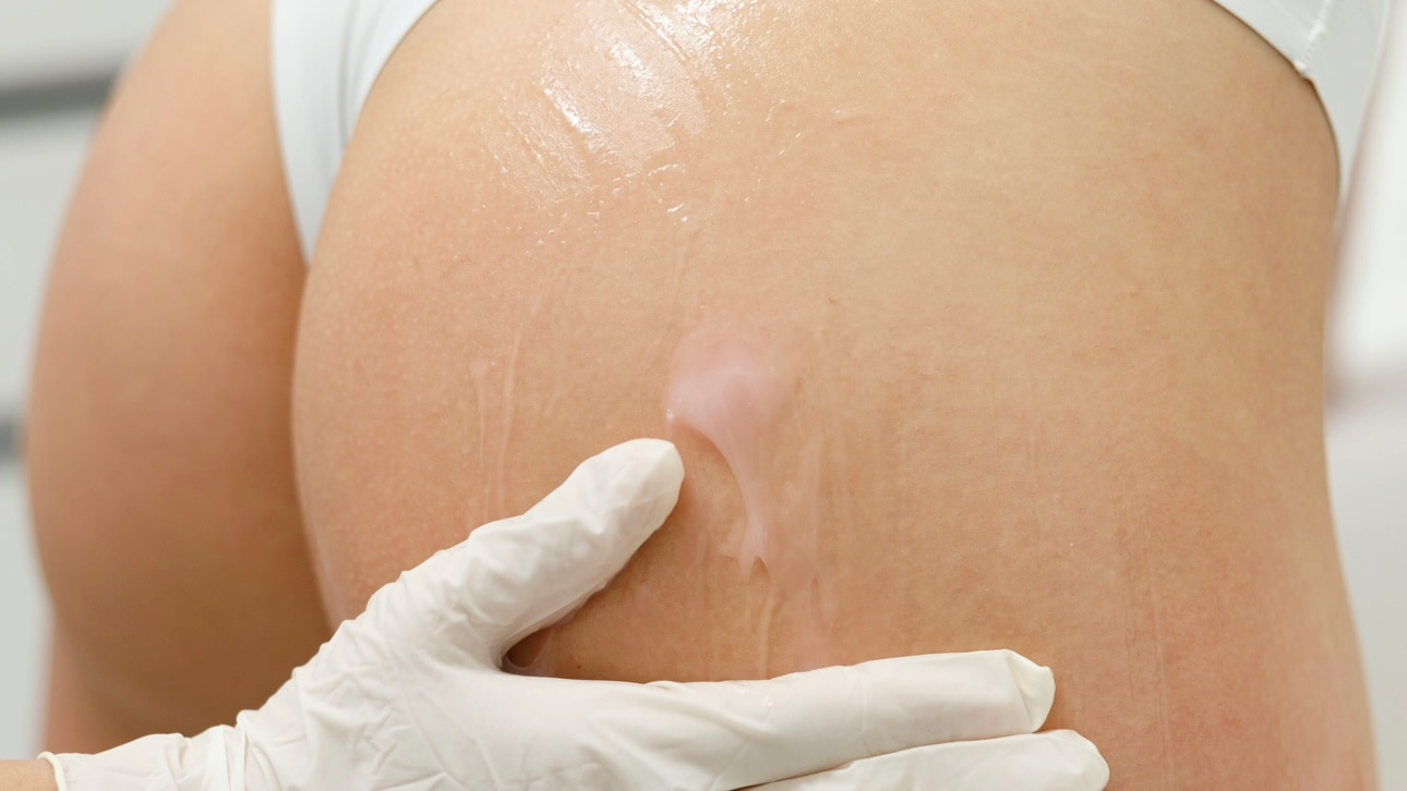 Антицелюлітні програми