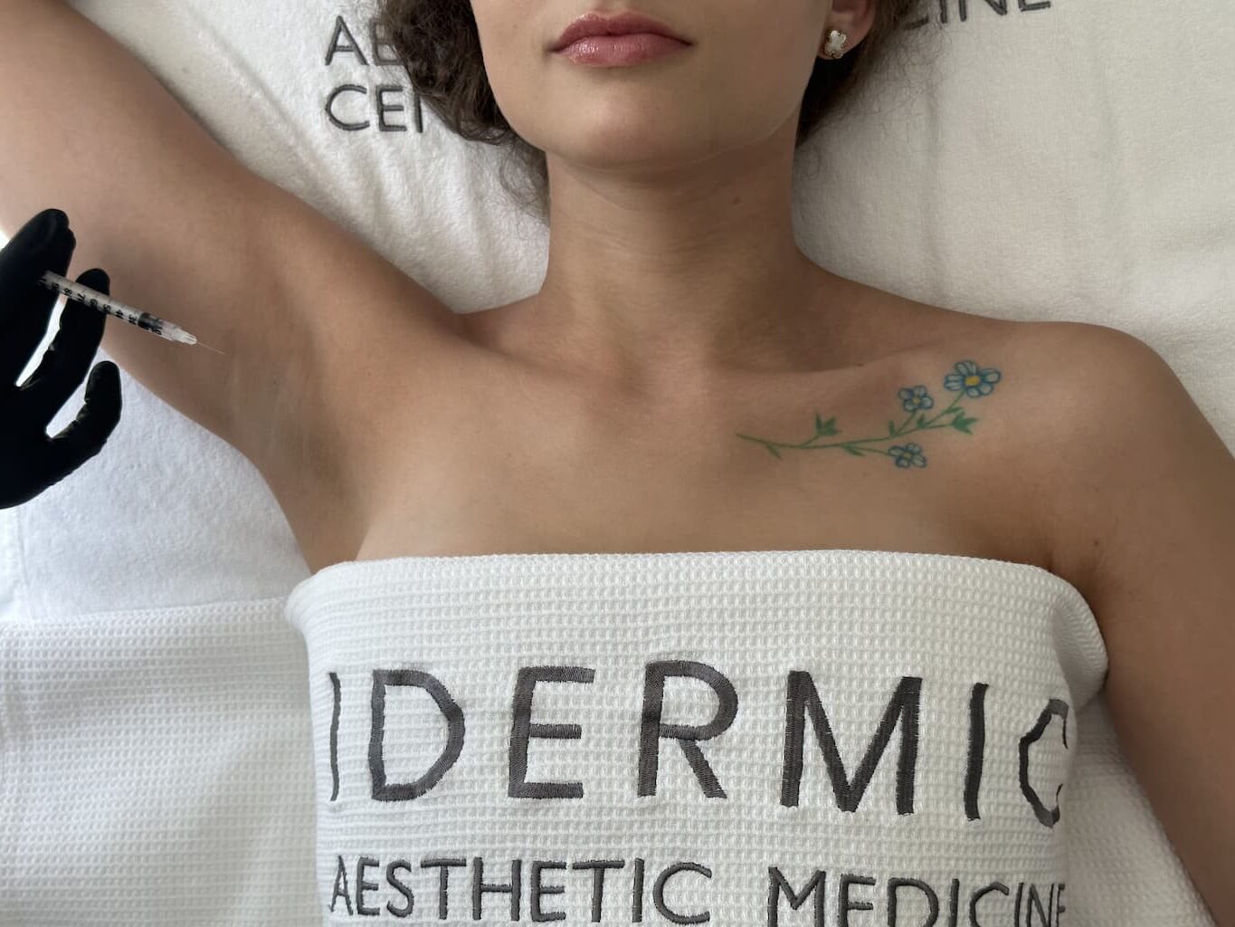 Лікування Гіпергідрозу