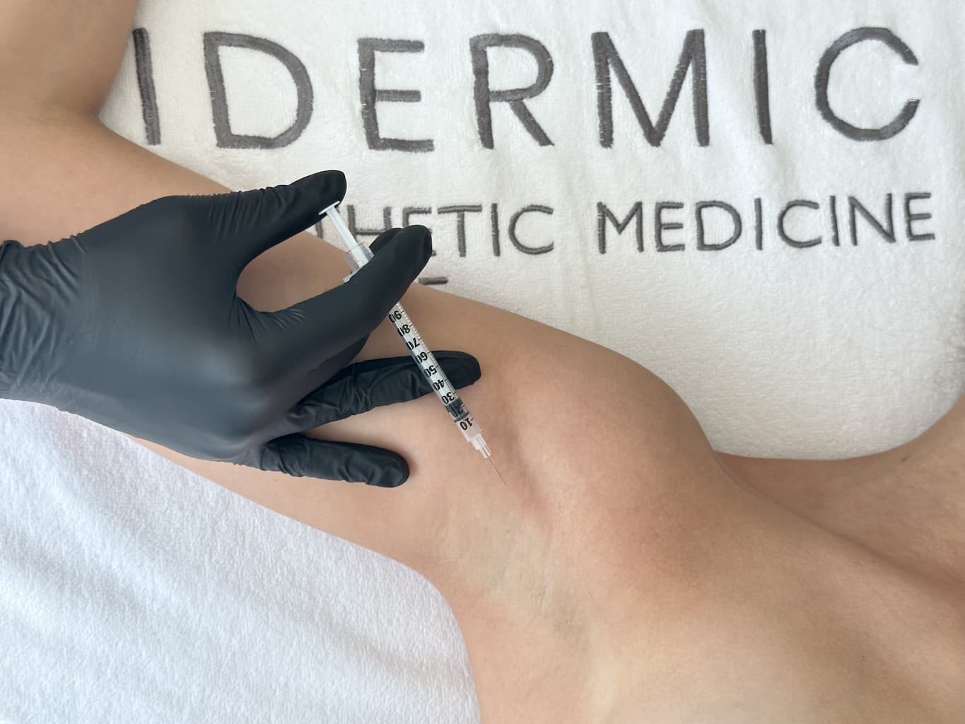 Лікування гіпергідрозу - хід процедури