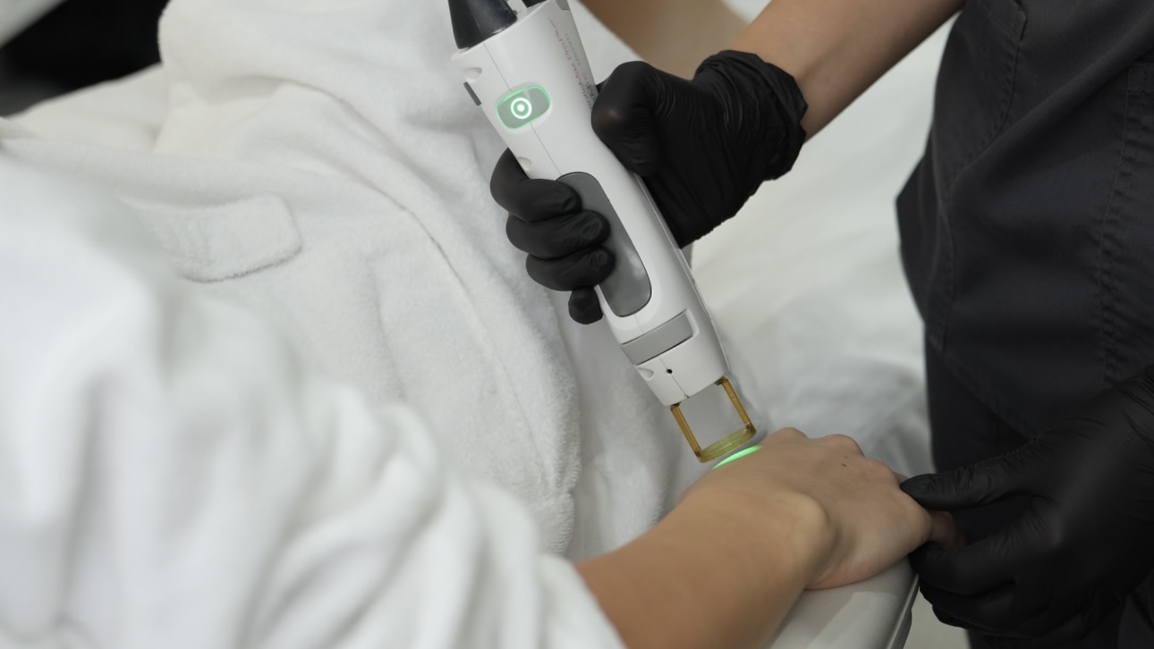 Лазерна епіляція