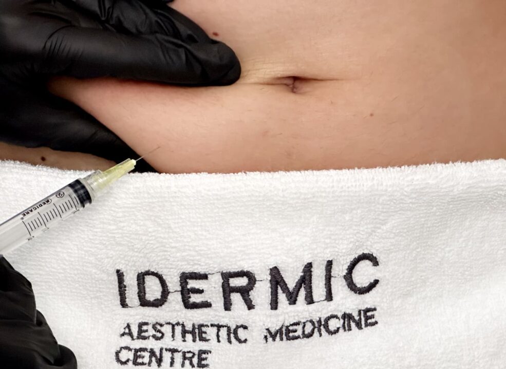Ін'єкції ліполітиків по тілу PB Serum у центрі IDERMIC у Львові