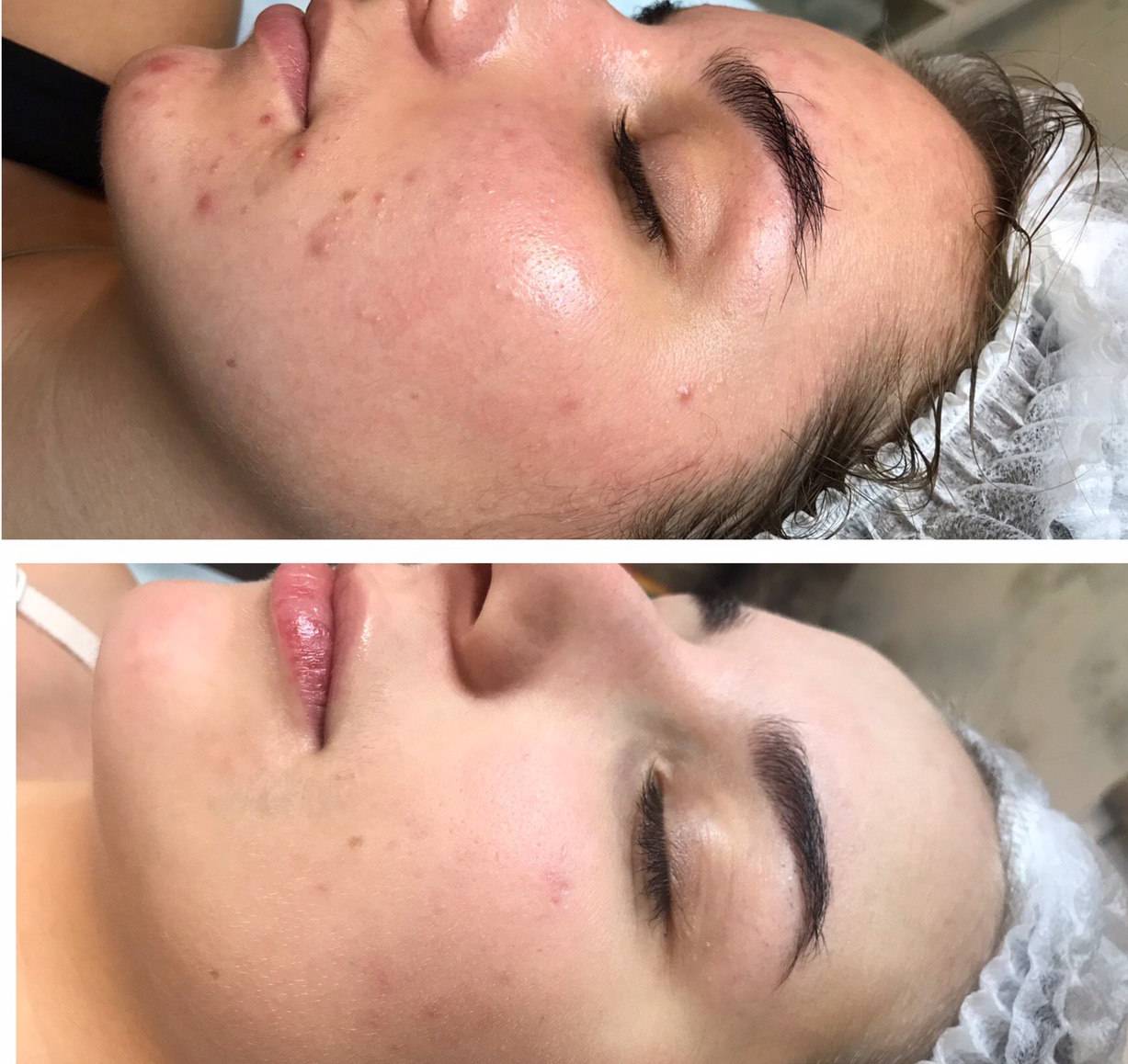 Як зробити шкіру обличчя ідеальною? Як зробити шкіру обличчя ідеальною?