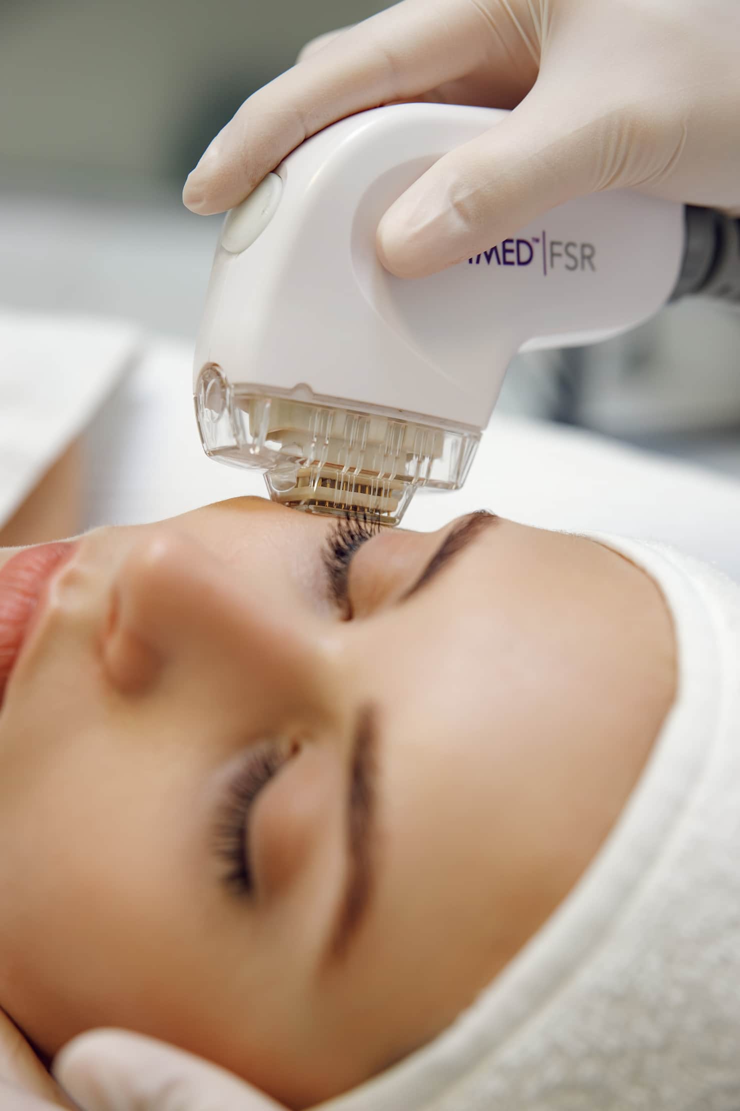 Яким Апаратом проводять RF - ліфтинг?