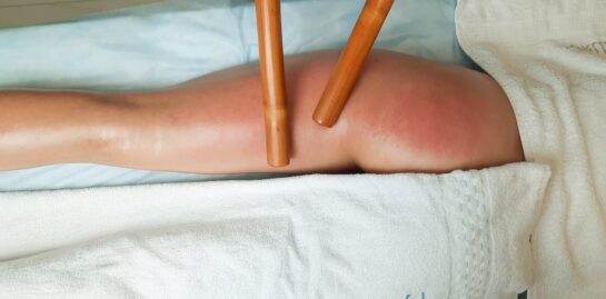 Масаж бамбуковими паличками