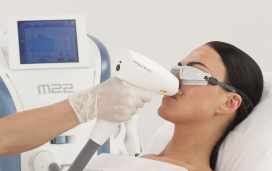 Апарат Lumenis M22 Апарат Lumenis M22