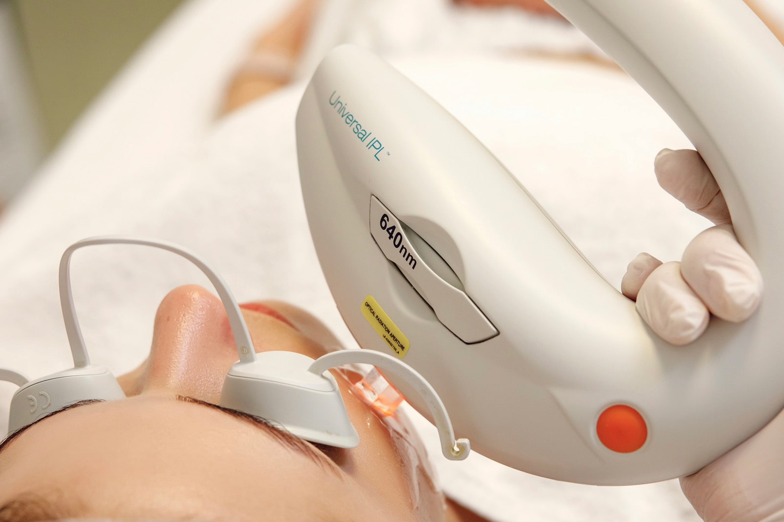 Лазерне видалення судин у Львові