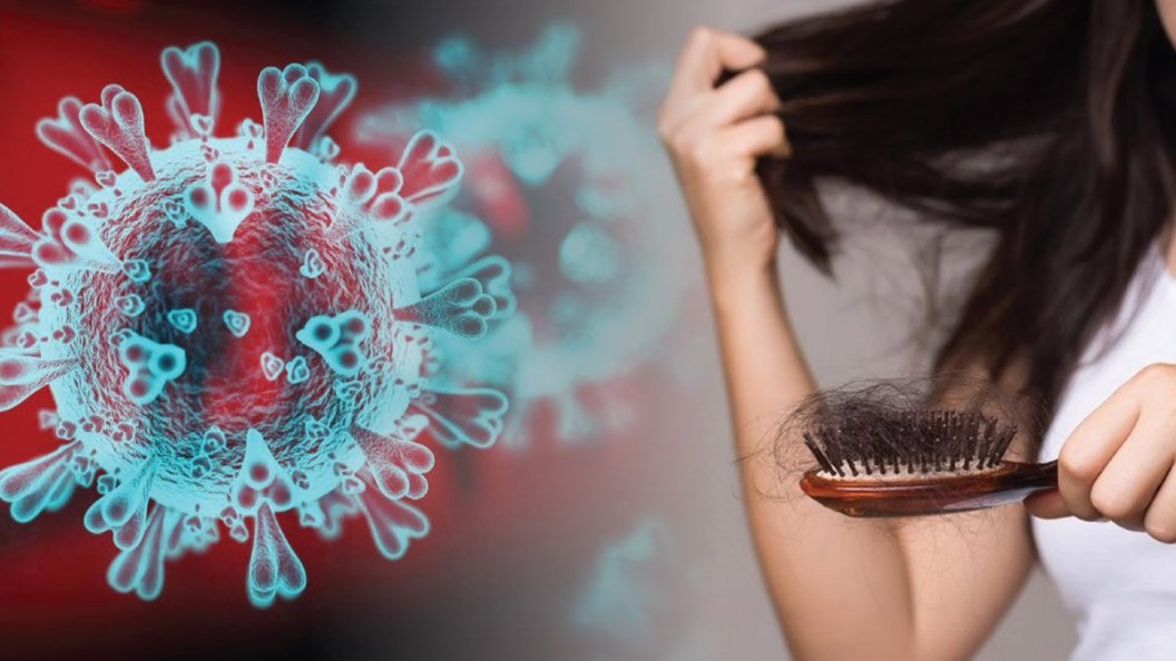 COVID 19 та його вплив на здоров’я волосся.