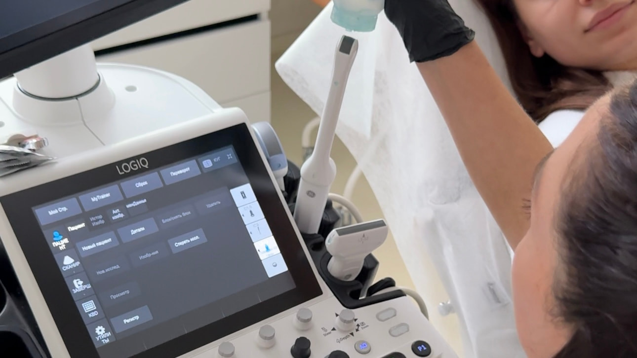 УЗД гінекологія