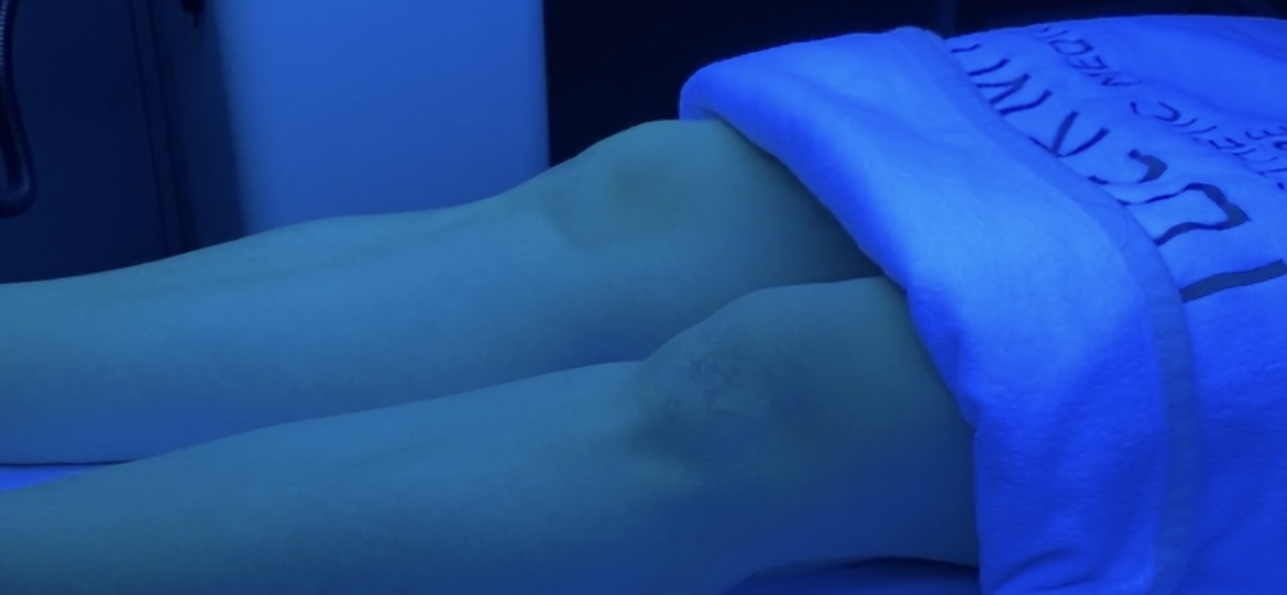 Фототерапія UVB Kernel