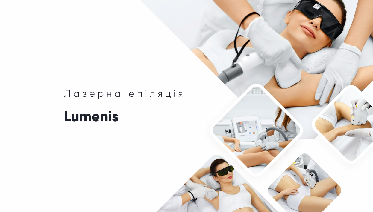 Лазерна епіляція Lumenis