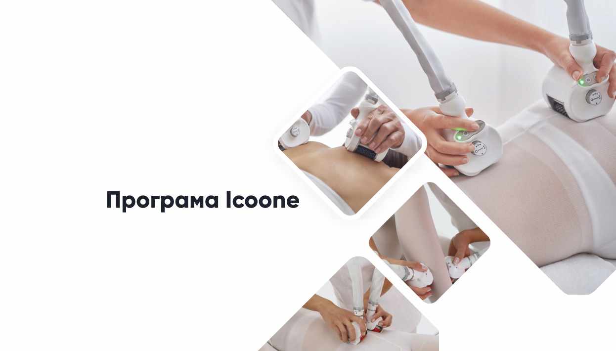 Програма Icoone
