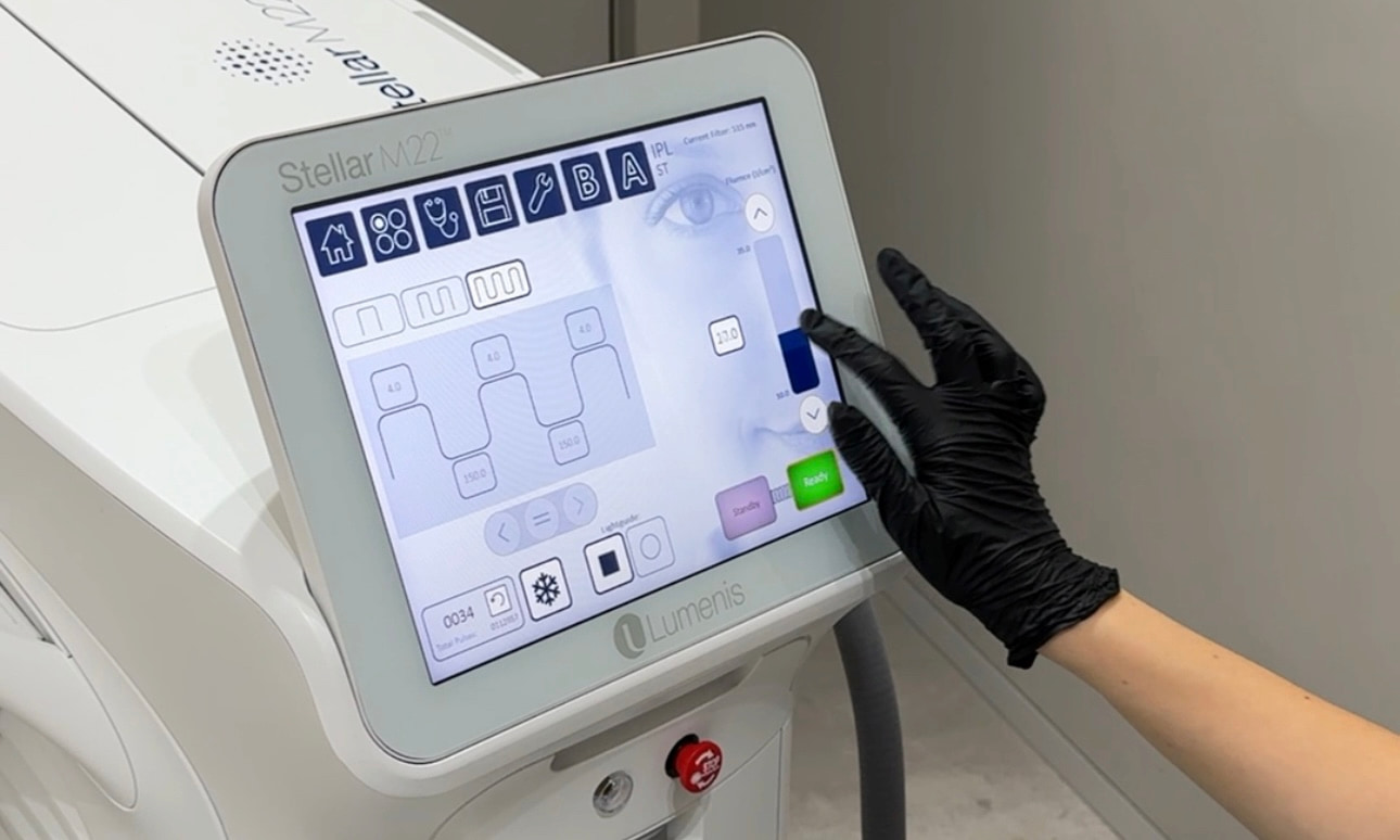 Лазерне шліфування Постакне