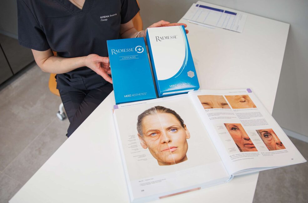 Обробка судинних проявів купероз апаратом IPL у центрі IDERMIC, Львів