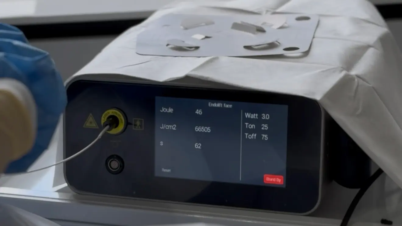 Апарат Endolift (Eufoton LASEmaR 1500) з підключеним оптичним волокном і параметрами обробки обличчя в центрі IDERMIC у Львові